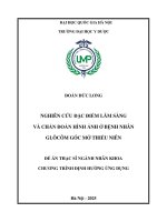 Luận văn nghiên cứu Đặc Điểm lâm sàng và chẩn Đoán hình Ảnh Ở bệnh nhân glôcôm góc mở thiếu niên